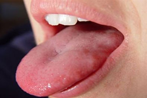 Đang ăn cắn vào lưỡi là điềm gì? Đánh con gì?-4