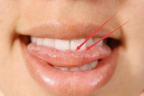 Đang ăn cắn vào lưỡi là điềm gì? Đánh con gì?-3
