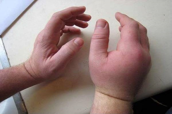 Bị ong đốt là điềm gì? Đánh số mấy dễ trúng?-3